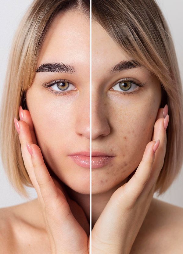 Skin concern